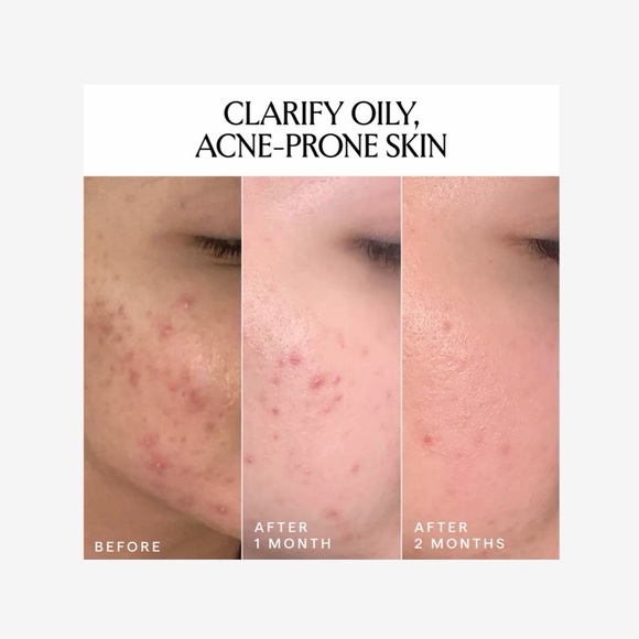 HERBIVORE Lapis Balancing Facial Oil Full Size - Picture 4 of 8